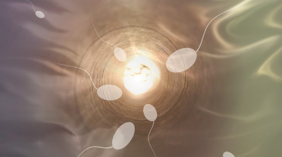 laqueadura-igreja-catolica